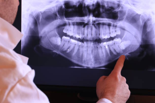 Best Cracked Tooth Emergency Dentist  in Wales, WI